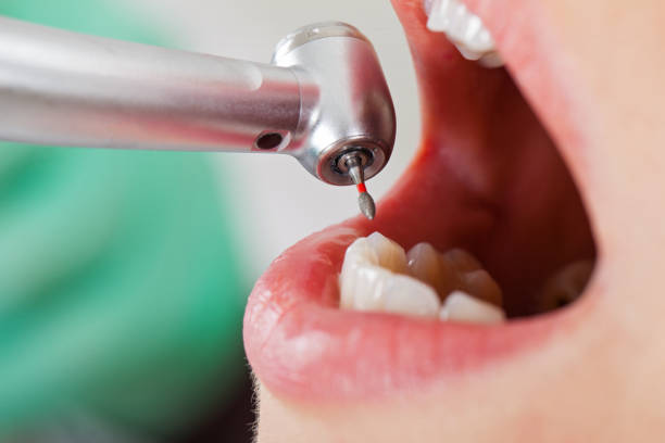 Best Mobile Emergency Dentist in Watonga, OK